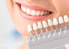 Best Tooth Filling in Chandigarh